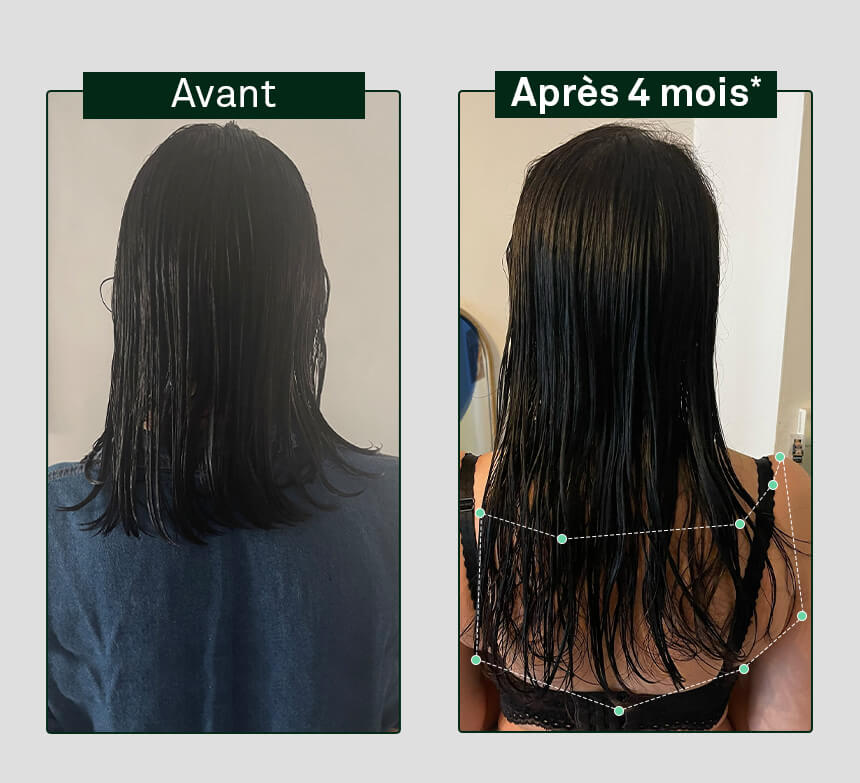 image avant/après