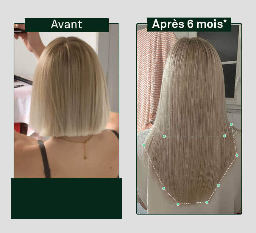 rebento-crescimento-fortificação-x3